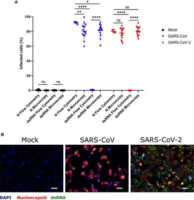 No Evidence for Human Monocyte-Derived Macrophage Infection and Antibody-Mediated Enhancement of SARS-CoV-2 Infection